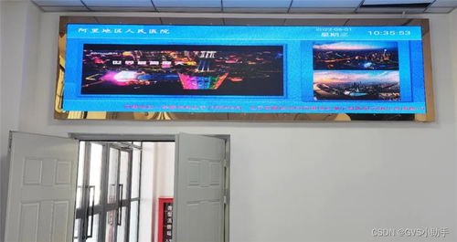 GVS視聲挺進西藏，為阿里地區人民醫院打造全時高效智慧醫療體驗